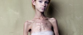 types of anorexia nervosa