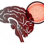 Вирусный менингит: симптомы у детей и взрослых, инкубационный период, лечение и профилактика заболевания