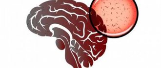 Вирусный менингит: симптомы у детей и взрослых, инкубационный период, лечение и профилактика заболевания