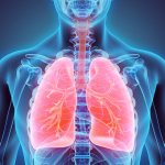 lung diseases