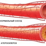 Why is it necessary to cleanse the blood vessels of the brain?