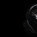 Sign up for an MRI of cerebral vessels in Moscow