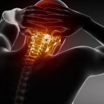 затылочная мигрень симптомы